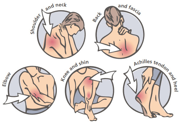 2 Shockwave Extracorporeal Therapy Los Angeles Pasadena Knee Pain Shoulder Pain Management Surgery Alternative